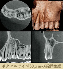 ボクセルサイズ80μmの高解像度