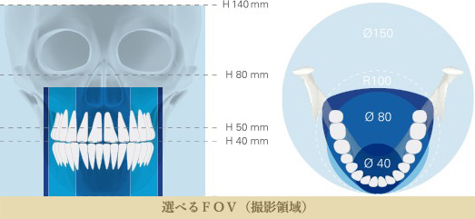 FOV（撮影領域）