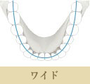 DDAE（デジタルダイレクトオートエクスポージャー）機能：ワイド