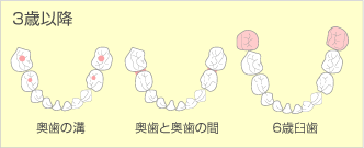 3歳以降