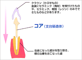 コア