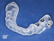 写真：surgical template