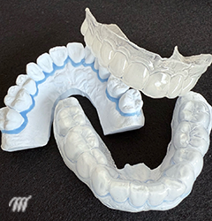 3DS除菌治療の写真