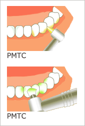 PMTC