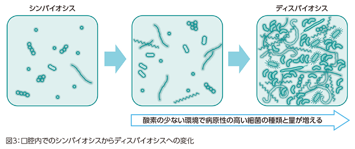 ディスバイオシスの図（引用：サンスター　Mouth & Body Topics Vol.5）
